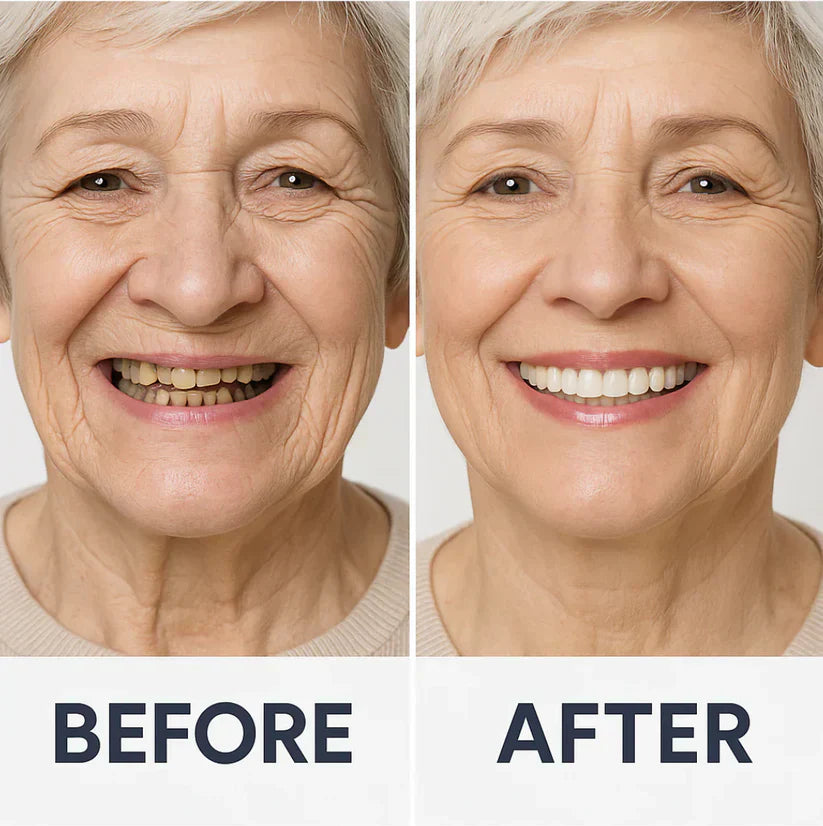 ✅ Made and Shipped from the US|Yagoo™ Suction-fit Complete Denture 🍀